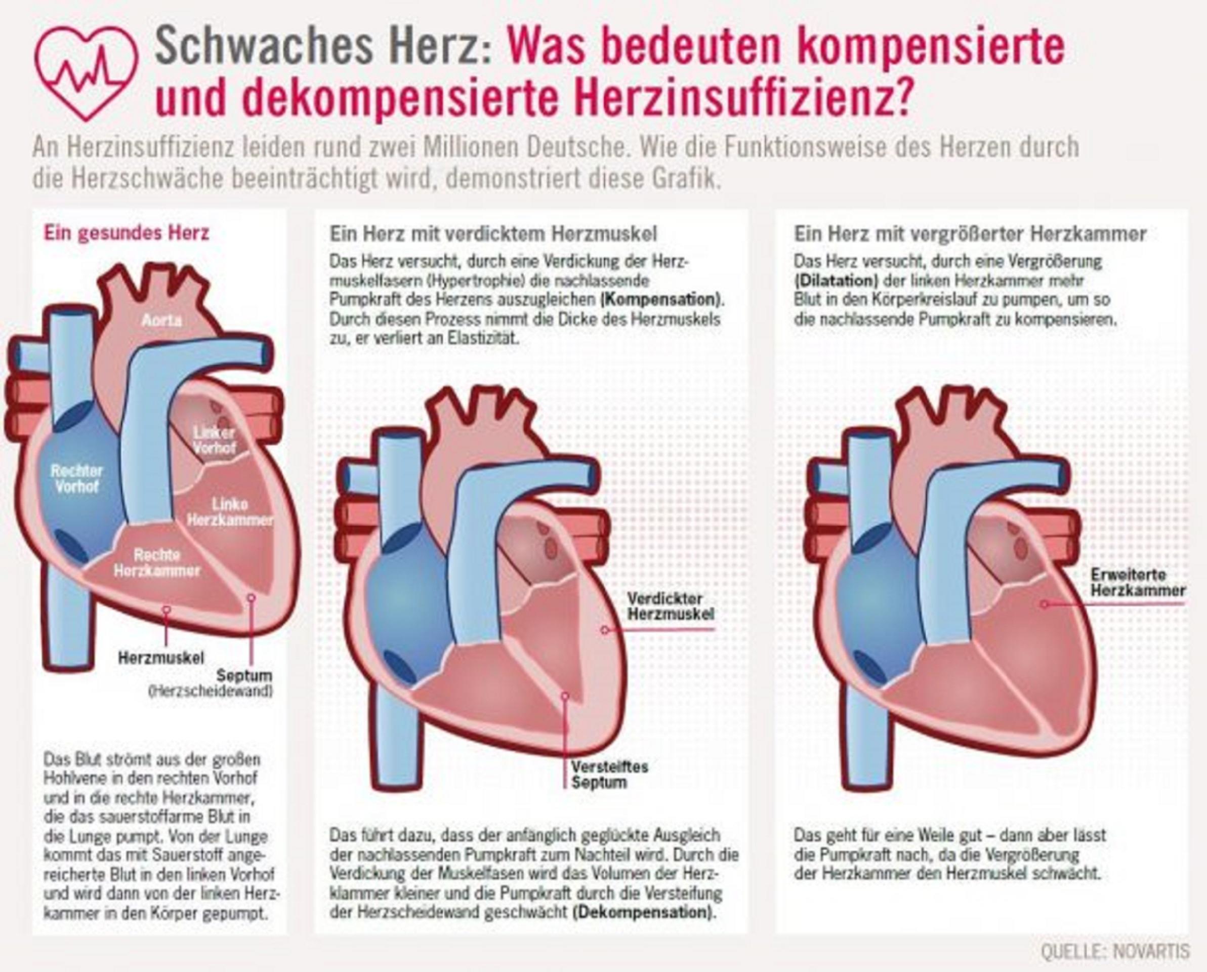 Kompensation