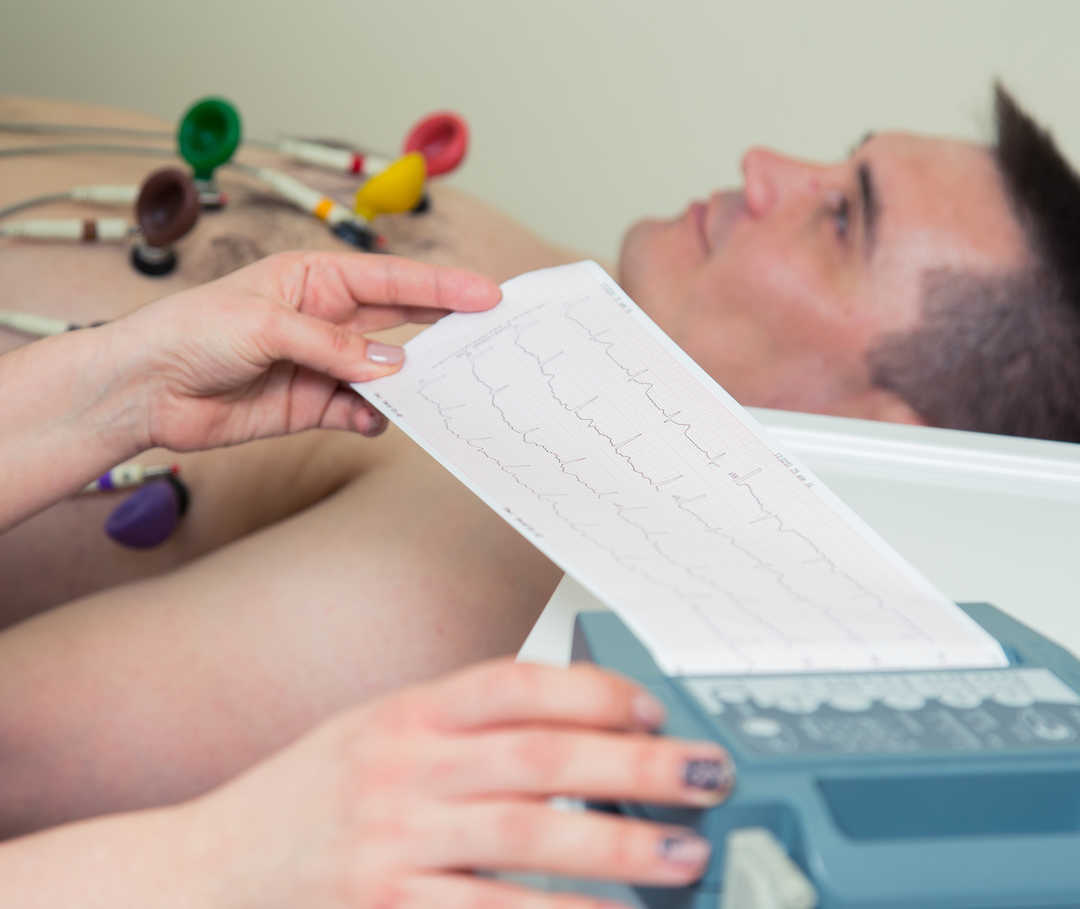 Ausdruck eines Elektrokardiogramms zur Diagnostik einer Kardiomyopathie.