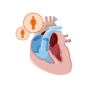 Grafische Darstellung der diastolischen Herzinsuffizienz.