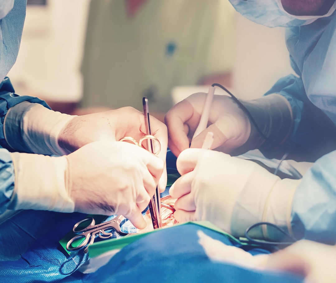 Operation einer Person mit Aortenklappeninsuffizienz.