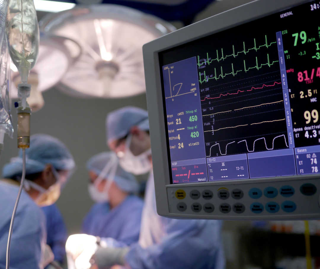 Ärzteteam und Überwachungsmonitor während einer Bypass-Operation am Herzen