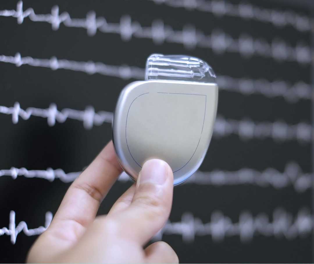 ICD-Implantation: Ärztin hält Defibrillator in der Hand.