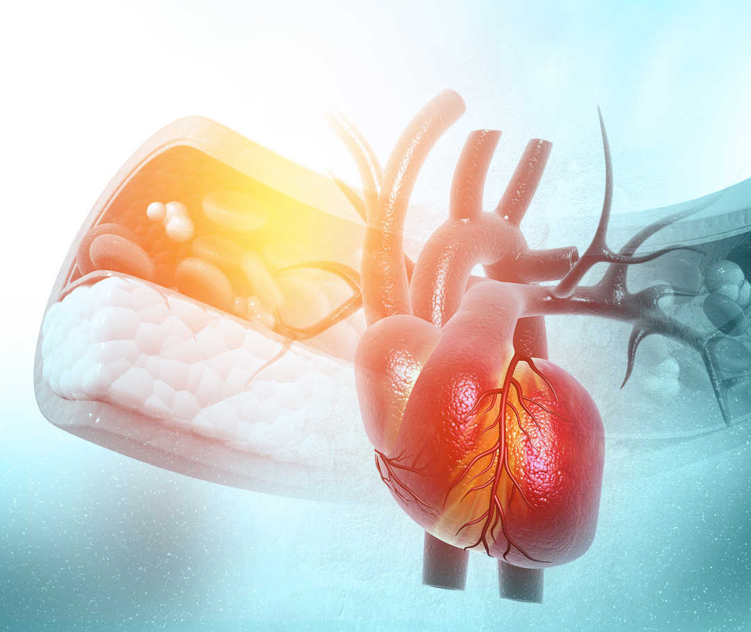 Hohe Cholesterinwerte schaden der Herzgesundheit. Bild zeigt Arterie als symbolischen Zusammenhang zwischen Cholesterin und Herz.