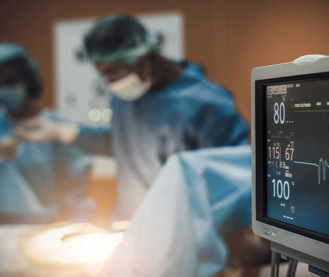 Eine Herztransplantation ist eine Option bei starker Herzschwäche. EKG-Monitor und Ärzteteam im OP bei einer Herztransplantation.