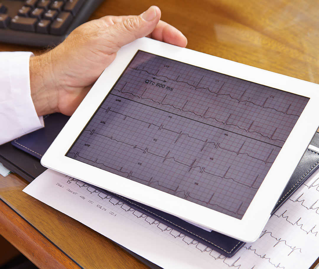 Arzt hält Tablet in der Hand und wertet einen EKG-Befund aus, der auf eine Herzrhythmusstörung hinweist.
